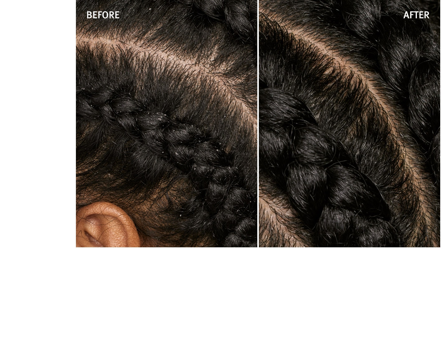 See the difference when using scalp solutions