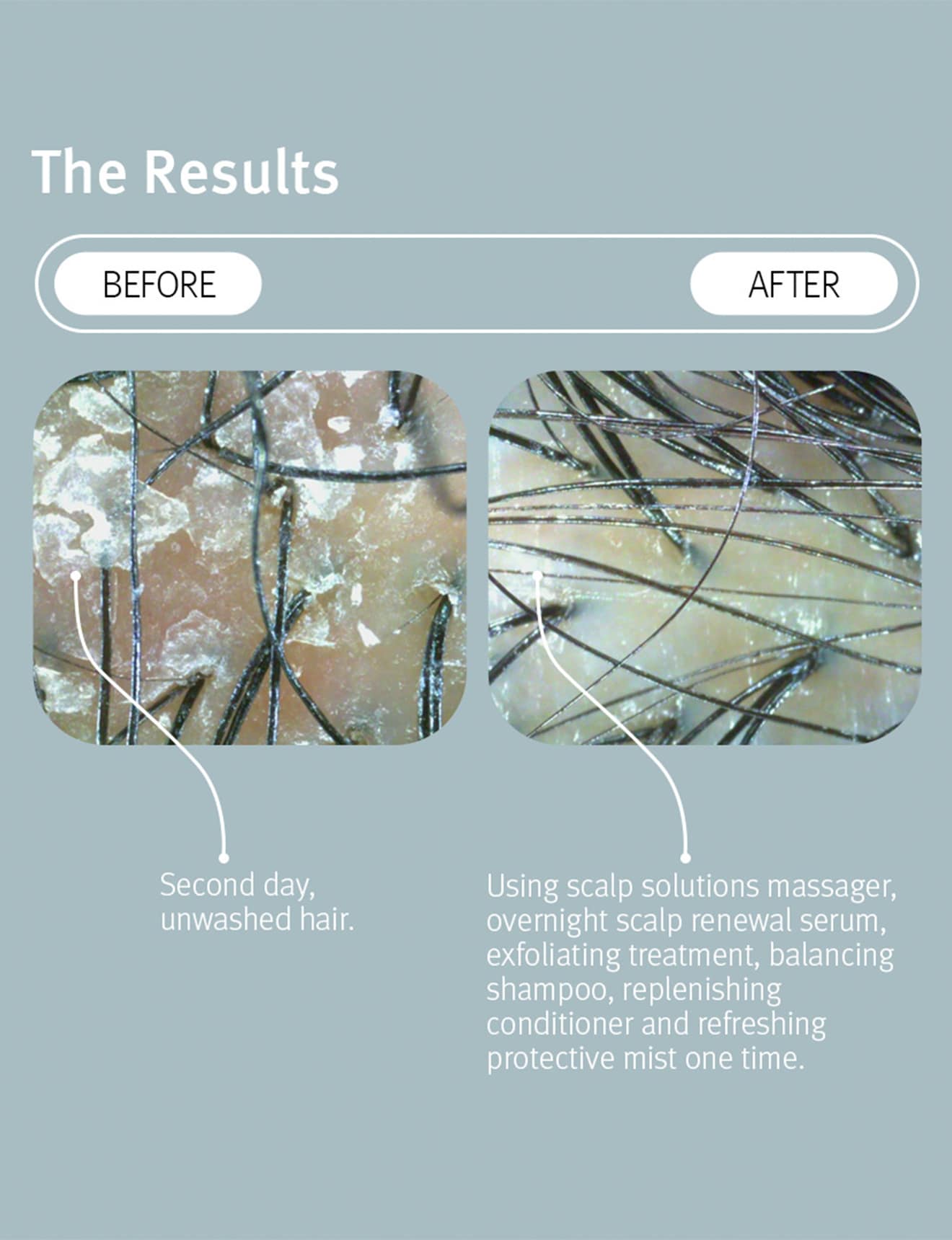 scalp solutions set